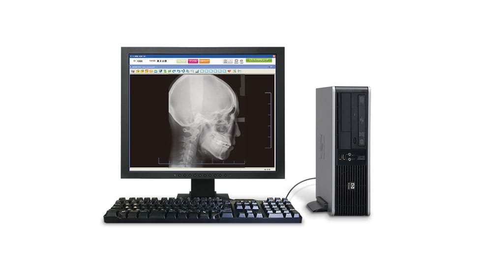 歯列矯正の診断に欠かせない横顔の骨格を測定するセファロ撮影装置